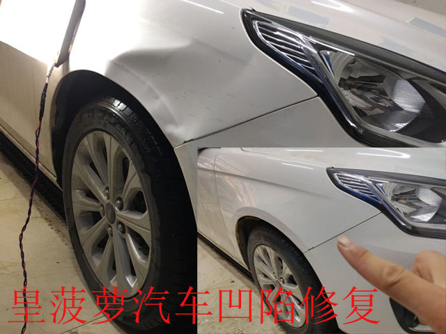 前葉子板凹陷修復 .jpg